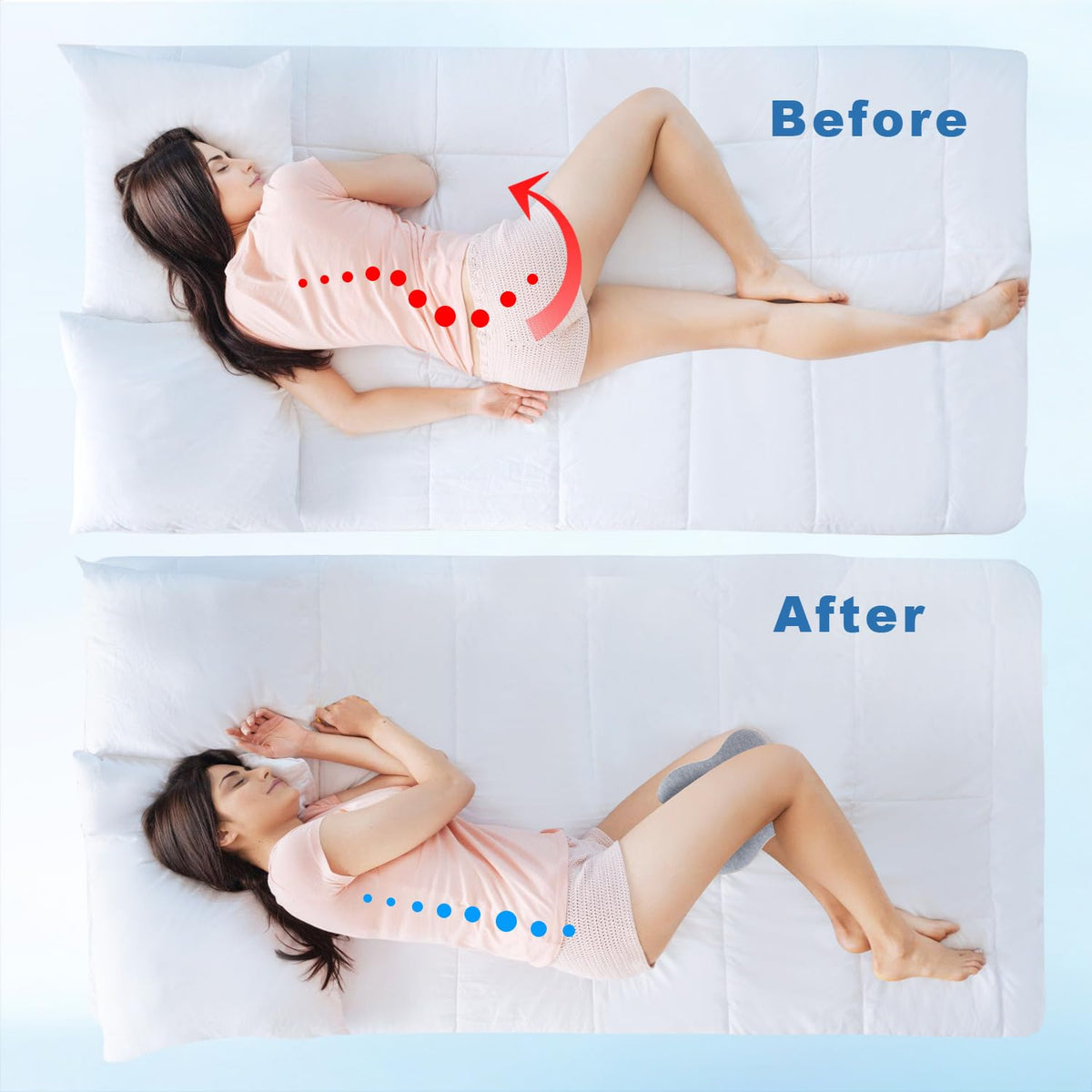 Anzhixiu pelvis-spine alignment image demonstrates improved hip posture.