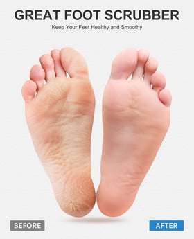 OTHWAY easy-clean design supports rinsing and quick drying after use.